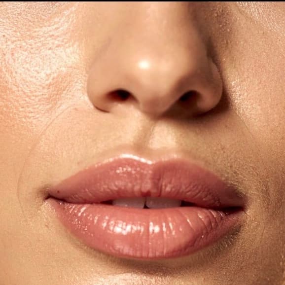 Upper Lip Laser-6 Sessions+2 Free at SLS Laser Medspa in Ontario, CA