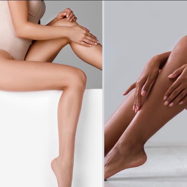 Full Legs Laser-6 Sessions+ 2 Free at SLS Laser Medspa in Ontario, CA